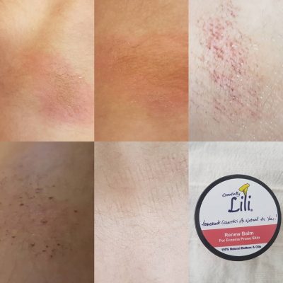 Renew Balm Before/After