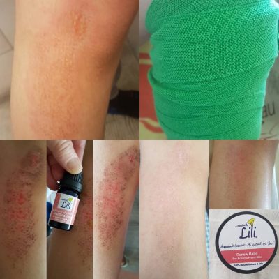 Renew Balm Just Soothing Testimonial