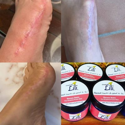 Before & After Renew Balm