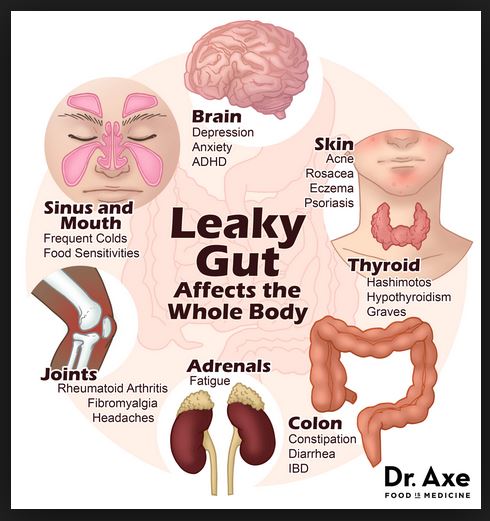 Dr Axe Leaky Gut