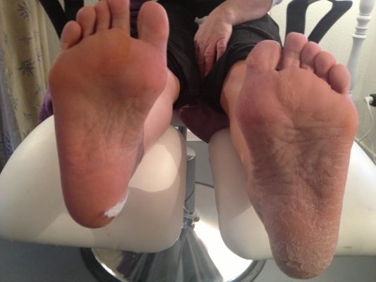 Yukky Feet