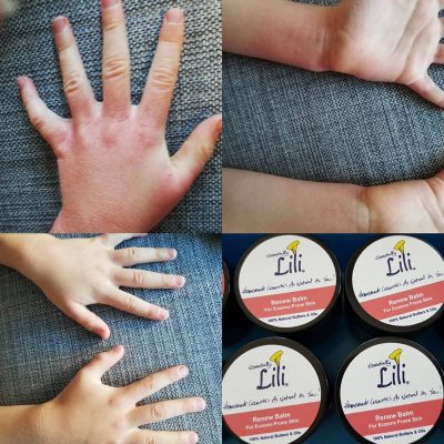Renew Balm Before & After