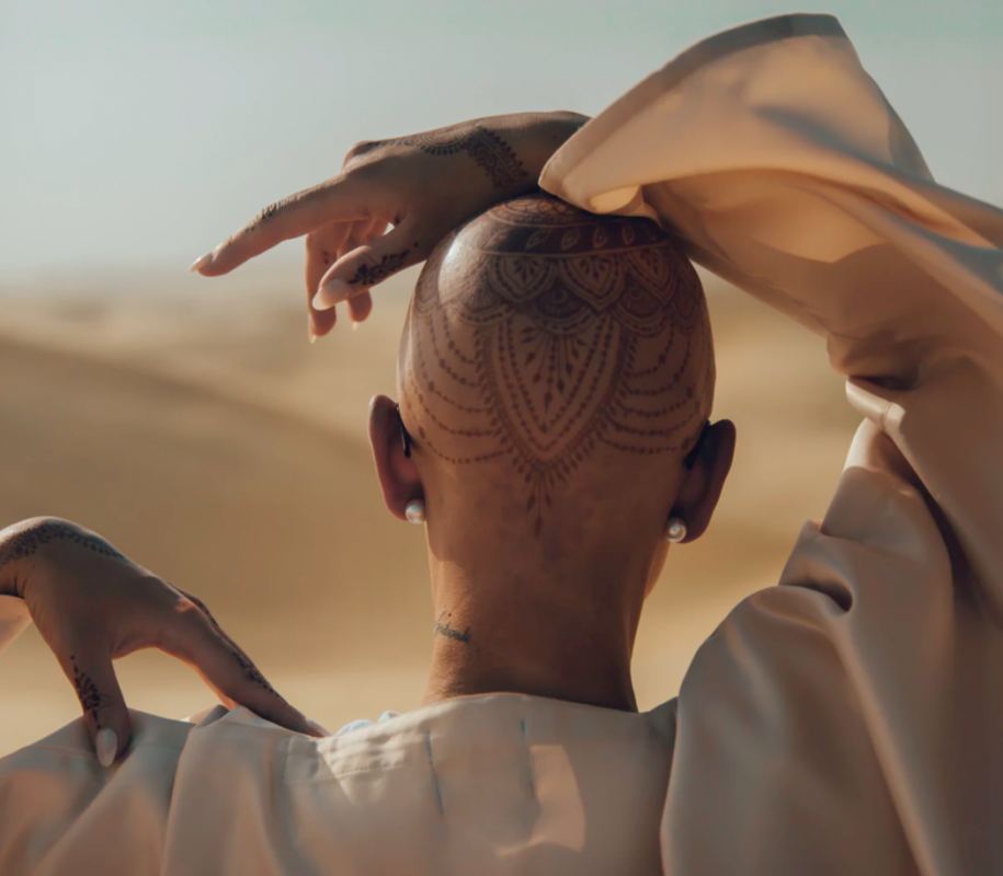 Alopecia Ahmed Carter 2 Jan2021